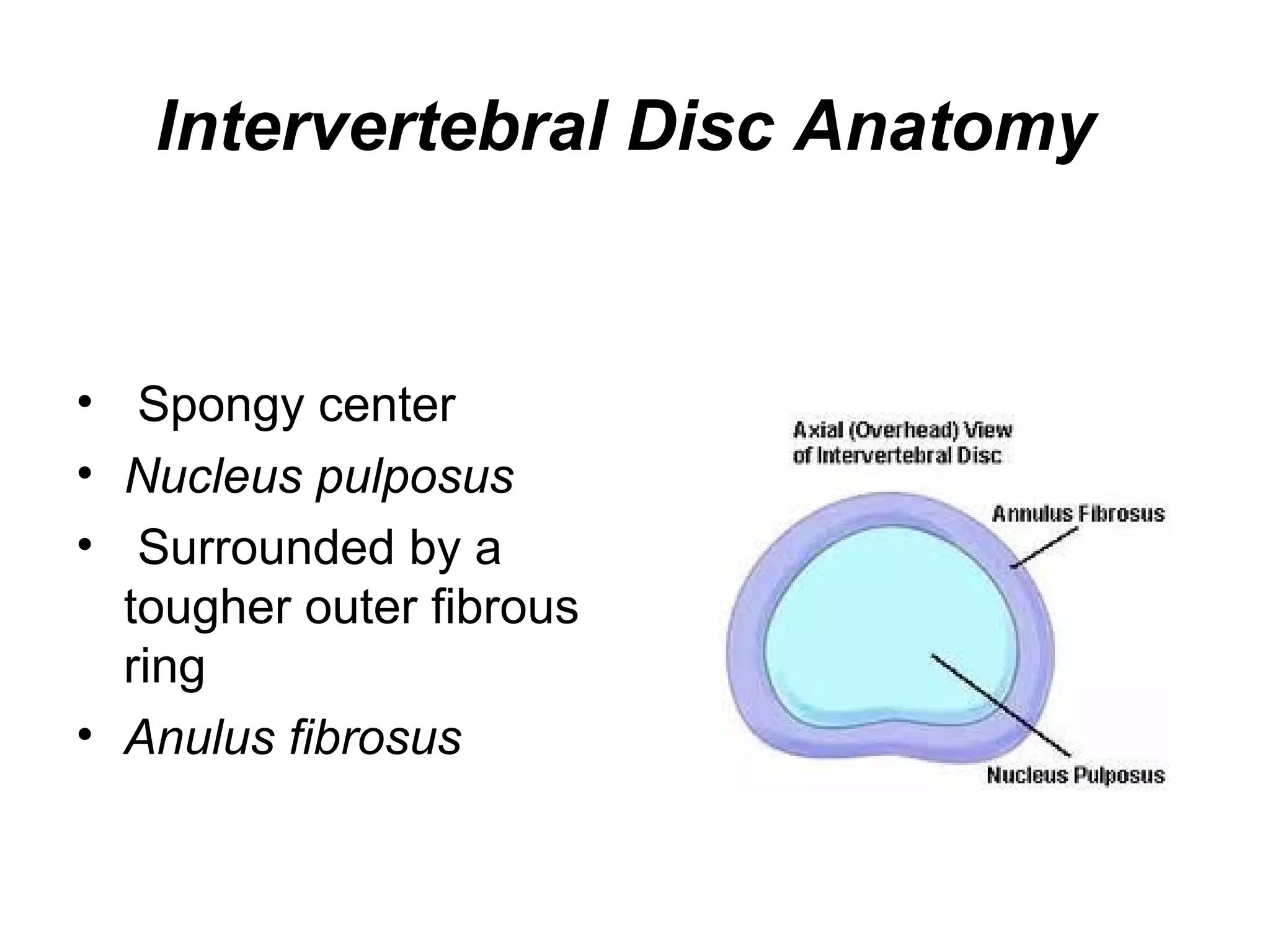 Intervertebral Disc Anatomy
• Spongy center
• Nucleus pulposus
• Surrounded by a
tougher outer fibrous
ring
• Anulus fibrosus
 