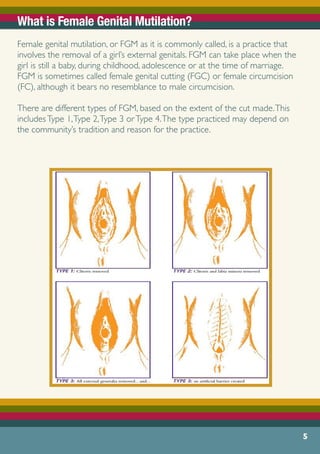 5
What is Female Genital Mutilation?
Female genital mutilation, or FGM as it is commonly called, is a practice that
involves the removal of a girl’s external genitals. FGM can take place when the
girl is still a baby, during childhood, adolescence or at the time of marriage.
FGM is sometimes called female genital cutting (FGC) or female circumcision
(FC), although it bears no resemblance to male circumcision.
There are different types of FGM, based on the extent of the cut made.This
includesType 1,Type 2,Type 3 orType 4.The type practiced may depend on
the community’s tradition and reason for the practice.
 