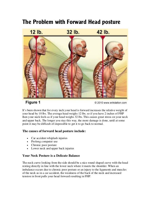 Forward Head Posture (FHP) Correction