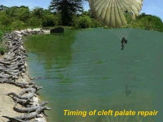 Timing of cleft palate repair 