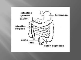 Fosa Ilíaca Derecha