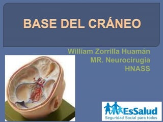 William Zorrilla Huamán
MR. Neurocirugia
HNASS
 