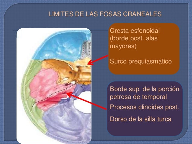 FOSA CRANEAL ANTERIOR