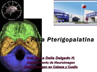 Fosa Pterigopalatina  Dra. Rosa Delia Delgado H. Departamento de Neuroimagen Unidad Imagen en Cabeza y Cuello 