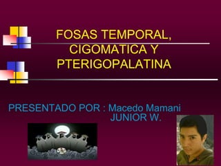 FOSAS TEMPORAL,
CIGOMATICA Y
PTERIGOPALATINA

PRESENTADO POR : Macedo Mamani
JUNIOR W.

 