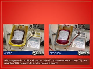 A la imagen se le modificó el tono en rojo (-17) y la saturación en rojo (+79) y en
amarillo(-100), destacando la color rojo de la sangre
ANTES DESPUÉS
 
