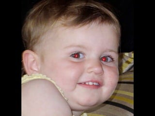 ALVEJANTES,
camisetas e papéis em branco tem
substâncias fluorescentes para aumentar
a sensação de brancor, 
e essa cor interfere na calibração.
 