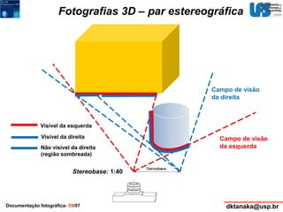 Fotografias 3D – par estereográfica 
Visível da esquerda 
Visível da direita 
Não visível da direita 
(região sombreada) 
Stereobase: 1:40 
Campo de visão 
da direita 
Campo de visão 
da esquerda 
Documentação fotográfica- 59/97 dktanaka@usp.br 
 
