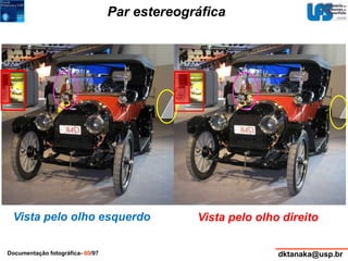 Par estereográfica 
Vista pelo olho esquerdo Vista pelo olho direito 
Documentação fotográfica- 60/97 dktanaka@usp.br 
 