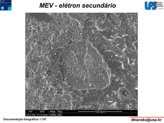 MEV - elétron secundário 
Documentação fotográfica- 61/97 dktanaka@usp.br 
 