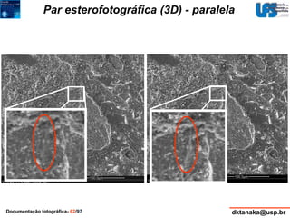 Par esterofotográfica (3D) - paralela 
Documentação fotográfica- 62/97 dktanaka@usp.br 
 
