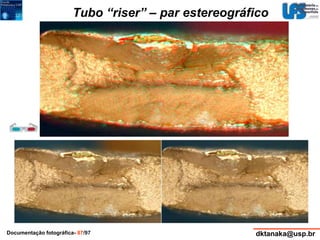Tubo “riser” – par estereográfico 
Documentação fotográfica- 87/97 dktanaka@usp.br 
 