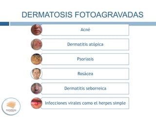 DERMATOSIS
FOTOAGRAVADAS
Acné
Dermatitis atópica
Psoriasis
Rosácea
Dermatitis seborreica
Infecciones virales como el herpes simple
DERMATOSIS
FOTOAGRAVADAS
DERMATOSIS FOTOAGRAVADAS
 
