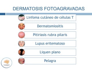 DERMATOSIS
FOTOAGRAVADAS
Linfoma cutáneo de células T
Dermatomiositis
Pitiriasis rubra pilaris
Lupus eritematoso
Liquen plano
Pelagra
DERMATOSIS
FOTOAGRAVADAS
DERMATOSIS FOTOAGRAVADAS
 