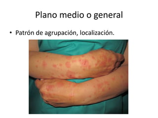 Plano medio o general
• Patrón de agrupación, localización.
 