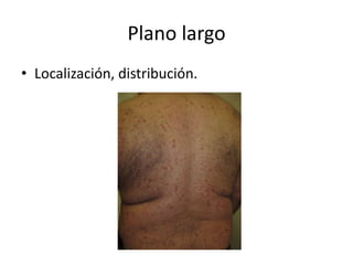 Plano largo
• Localización, distribución.
 