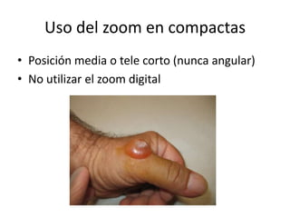 Uso del zoom en compactas
• Posición media o tele corto (nunca angular)
• No utilizar el zoom digital
 