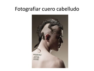 Fotografiar cuero cabelludo
 