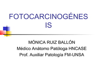 FOTOCARCINOGÉNES
IS
MÓNICA RUIZ BALLÓN
Médico Anátomo Patóloga HNCASE
Prof. Auxiliar Patología FM-UNSA
 