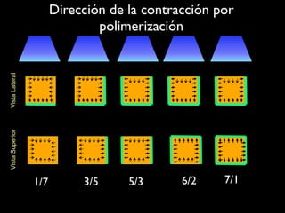 Dirección de la contracción por
                               polimerización
Vista Lateral
Vista Superior




                 1/7        3/5     5/3      6/2    7/1
 