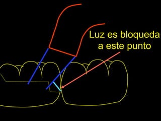 Luz es bloqueda
  a este punto
 