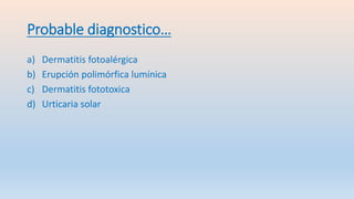 Probable diagnostico…
a) Dermatitis fotoalérgica
b) Erupción polimórfica lumínica
c) Dermatitis fototoxica
d) Urticaria solar
 