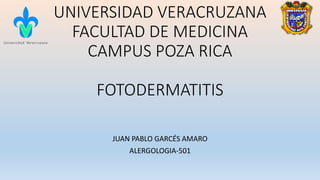UNIVERSIDAD VERACRUZANA
FACULTAD DE MEDICINA
CAMPUS POZA RICA
FOTODERMATITIS
JUAN PABLO GARCÉS AMARO
ALERGOLOGIA-501
 