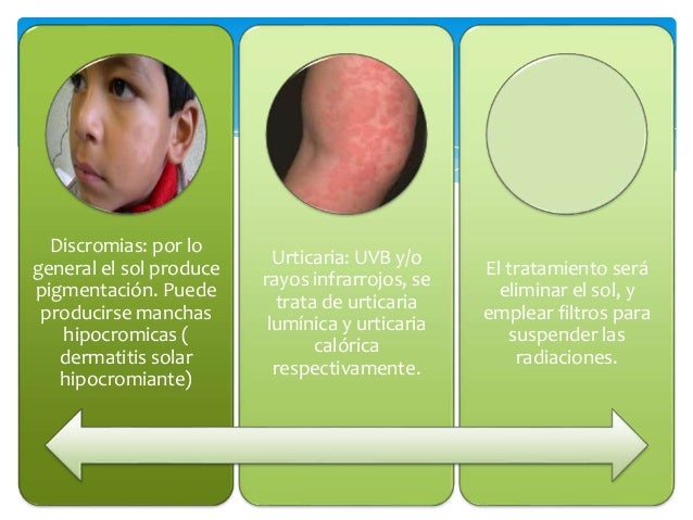Https Www Studocu Com Es Mx Document Universidad Autonoma Del Estado De Morelos Dermatologia Apuntes 8 Discromias Dermatologia 2981199 View