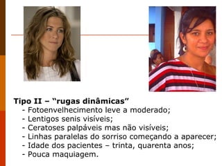 Tipo II – “rugas dinâmicas” - Fotoenvelhecimento leve a moderado; - Lentigos senis visíveis; - Ceratoses palpáveis mas não visíveis; - Linhas paralelas do sorriso começando a aparecer; - Idade dos pacientes – trinta, quarenta anos; - Pouca maquiagem. 