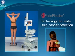 technology for early skin cancer detection  