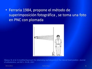 • Ferraria 1984, propone el método de
   superimposición fotográfica , se toma una foto
   en PNC con plomada




Sleeva, N; et al. A modified Approach for obtainaing cephalograms in the natural head position. Journal
of orthodontics, vol 28(1): 25-28, 2001
 04/11/2011                                     Carlos Paco                                           36
 