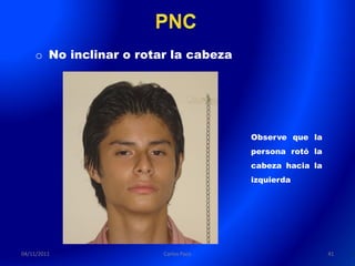 o No inclinar o rotar la cabeza




                                      Observe que la
                                      persona rotó la
                                      cabeza hacia la
                                      izquierda




04/11/2011              Carlos Paco                     41
 