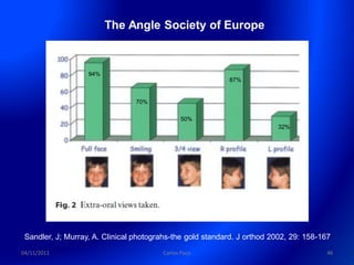 The Angle Society of Europe


                   94%
                                                           87%


                                 70%

                                              50%
                                                                         32%




 Sandler, J; Murray, A. Clinical photograhs-the gold standard. J orthod 2002, 29: 158-167
04/11/2011                              Carlos Paco                                    46
 