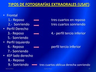 TIPOS DE FOTOGRAFÍAS EXTRAORALES (USAT):

• Frontal
   1.- Reposo                     tres cuartos en reposo
   2.- Sonriendo                  tres cuartos sonriendo
• Perfil Derecho
   3.- Reposo                     4.- perfil tercio inferior
   5.- Sonriendo
• Perfil Izquierdo
   6.- Reposo                     perfil tercio inferior
   7.- Sonriendo
• 45º lado derecho
   8.- Reposo
   9.- Sonriendo     tres cuartos oblicua derecha sonriendo
 04/11/2011             Carlos Paco                            47
 