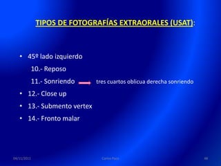 TIPOS DE FOTOGRAFÍAS EXTRAORALES (USAT):



   • 45º lado izquierdo
             10.- Reposo
             11.- Sonriendo   tres cuartos oblicua derecha sonriendo

   • 12.- Close up
   • 13.- Submento vertex
   • 14.- Fronto malar




04/11/2011                      Carlos Paco                            48
 