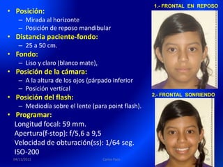 1.- FRONTAL EN REPOSO
• Posición:
   – Mirada al horizonte
   – Posición de reposo mandibular
• Distancia paciente-fondo:
   – 25 a 50 cm.
• Fondo:
   – Liso y claro (blanco mate),
• Posición de la cámara:
   – A la altura de los ojos (párpado inferior
   – Posición vertical
• Posición del flash:                              2.- FRONTAL SONRIENDO

   – Mediodía sobre el lente (para point flash).
• Programar:
  Longitud focal: 59 mm.
  Apertura(f-stop): f/5,6 a 9,5
  Velocidad de obturación(ss): 1/64 seg.
  ISO-200
 04/11/2011                        Carlos Paco                      49
 
