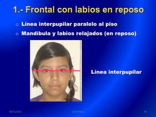 o Línea interpupilar paralelo al piso
    o Mandíbula y labios relajados (en reposo)




                                      Línea interpupilar




04/11/2011              Carlos Paco                        50
 