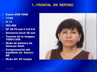1.- FRONTAL EN REPOSO

o Canon EOS 550D
o 1/125
o f= 11
o ISO 400
o EF 38-76 mm f/ 4.5-5.6
o Distancia focal 38 mm
o Tamaño de la imagen:
  1650x1350
o Modo de balance de
  blancos: flash
o Compensación del
  equilibrio de blanco:
  B8
o Modo AF: AF simple


  04/11/2011               Carlos Paco       52
 