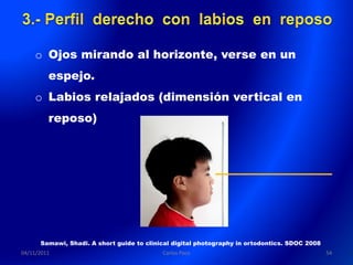 o Ojos mirando al horizonte, verse en un
         espejo.
    o Labios relajados (dimensión vertical en
         reposo)




      Samawi, Shadi. A short guide to clinical digital photography in ortodontics. SDOC 2008
04/11/2011                                 Carlos Paco                                         54
 