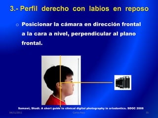 o Posicionar la cámara en dirección frontal
         a la cara a nivel, perpendicular al plano
         frontal.




      Samawi, Shadi. A short guide to clinical digital photography in ortodontics. SDOC 2008
04/11/2011                                 Carlos Paco                                         55
 