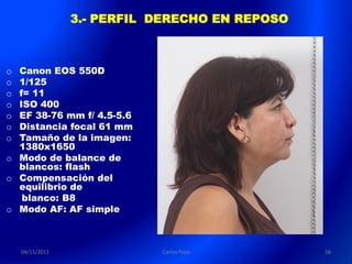 3.- PERFIL DERECHO EN REPOSO



o Canon EOS 550D
o 1/125
o f= 11
o ISO 400
o EF 38-76 mm f/ 4.5-5.6
o Distancia focal 61 mm
o Tamaño de la imagen:
  1380x1650
o Modo de balance de
  blancos: flash
o Compensación del
  equilibrio de
   blanco: B8
o Modo AF: AF simple



    04/11/2011              Carlos Paco         56
 