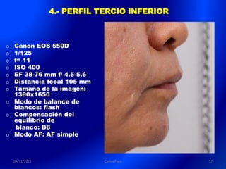 4.- PERFIL TERCIO INFERIOR



o Canon EOS 550D
o 1/125
o f= 11
o ISO 400
o EF 38-76 mm f/ 4.5-5.6
o Distancia focal 105 mm
o Tamaño de la imagen:
  1380x1650
o Modo de balance de
  blancos: flash
o Compensación del
  equilibrio de
   blanco: B8
o Modo AF: AF simple



    04/11/2011               Carlos Paco      57
 