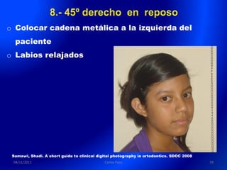 o Colocar cadena metálica a la izquierda del
  paciente
o Labios relajados




 Samawi, Shadi. A short guide to clinical digital photography in ortodontics. SDOC 2008
 04/11/2011                                  Carlos Paco                                  59
 