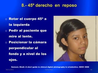 o Rotar el cuerpo 45º a
   la izquierda
o Pedir al paciente que
   mire al lente.
o Posicionar la cámara
   perpendicular al
   fondo y a nivel de los
   ojos.

      Samawi, Shadi. A short guide to clinical digital photography in ortodontics. SDOC 2008
04/11/2011                                 Carlos Paco                                         60
 