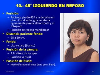 10.- 45° IZQUIERDO EN REPOSO
• Posición:
   – Paciente girado 45º a la derecha en
     dirección al lente, gira la cabeza
     ligeramente y mira al horizonte y al
     fotógrafo
   – Posición de reposo mandibular
• Distancia paciente-fondo:
   – 25 a 50 cm.
• Fondo:
   – Liso y claro (blanco)
• Posición de la cámara:
   – A la altura de los ojos
   – Posición vertical
• Posición del flash:
   – Mediodía sobre el lente (para point flash).

  04/11/2011                           Carlos Paco   62
 