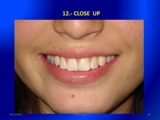 12.- CLOSE UP




04/11/2011      Carlos Paco   65
 