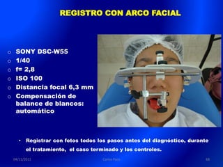 REGISTRO CON ARCO FACIAL




o    SONY DSC-W55
o    1/40
o    f= 2,8
o    ISO 100
o    Distancia focal 6,3 mm
o    Compensación de
     balance de blancos:
     automático



       •   Registrar con fotos todos los pasos antes del diagnóstico, durante
           el tratamiento, el caso terminado y los controles.
    04/11/2011                         Carlos Paco                          68
 