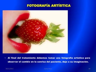 FOTOGRAFÍA ARTÍSTICA




•     Al final del tratamiento debemos tomar una fotografía artística para
      observar el cambio en la sonrisa del paciente, dejo a su imaginación.


    04/11/2011                       Carlos Paco                              69
 