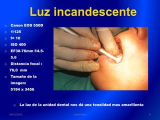 o   Canon EOS 550D
o   1/125
o   f= 10
o   ISO 400
o   EF38-76mm f/4.5-
    5.6
o   Distancia focal :
    76,0 mm
o   Tamaño de la
    imagen:
    5184 x 3456



       o   La luz de la unidad dental nos dá una tonalidad mas amarillenta

    04/11/2011                        Carlos Paco                            9
 