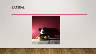LATERAL